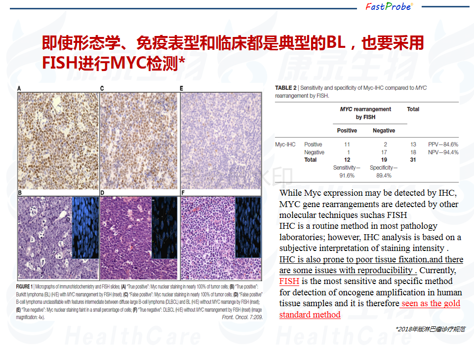 淋巴瘤FISH检测10件事 中到大大细胞篇_10.png